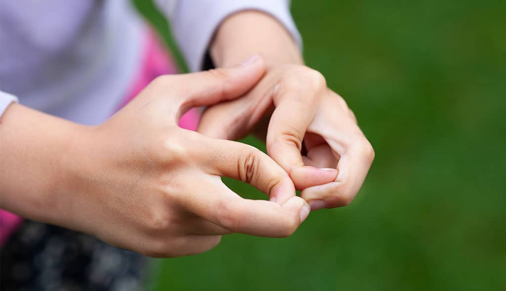 HYPERMOBILITY IN YOUNGER CHILDREN.